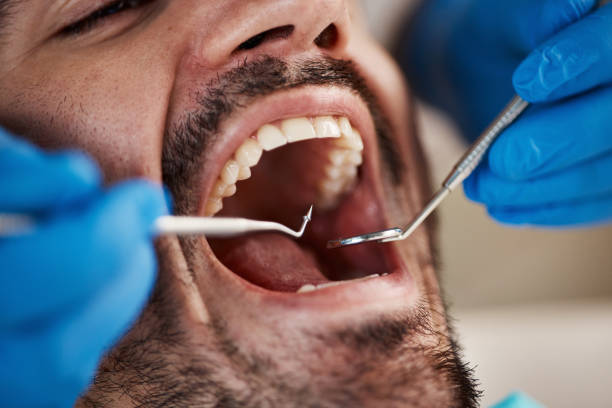 Best Emergency Dental Care for Broken or Chipped Teeth in Morrilton, AR